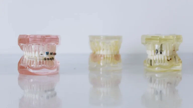 Close-up of dental models displaying braces and dentures for orthodontic education.