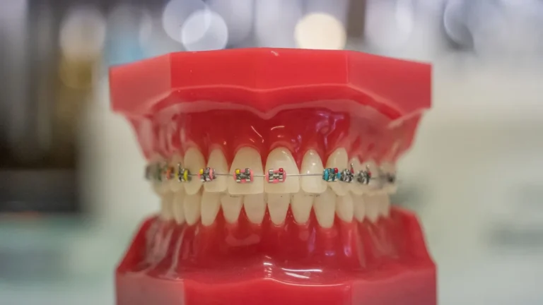 Model of human teeth with colorful braces, showcasing dental care and orthodontics.