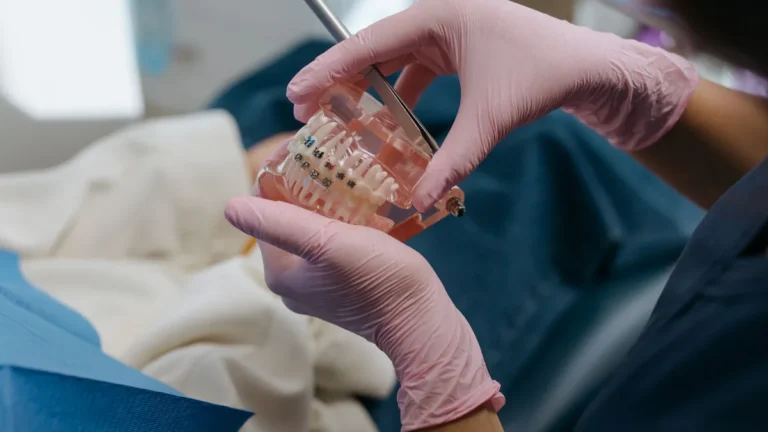 Close-up of a dental professional using tools on a teeth model with braces.