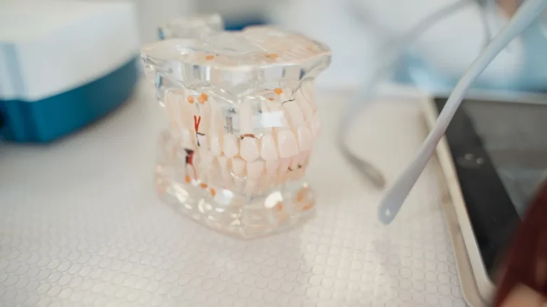 Close-up of a dental model on a clinic table, showcasing teeth anatomy.
