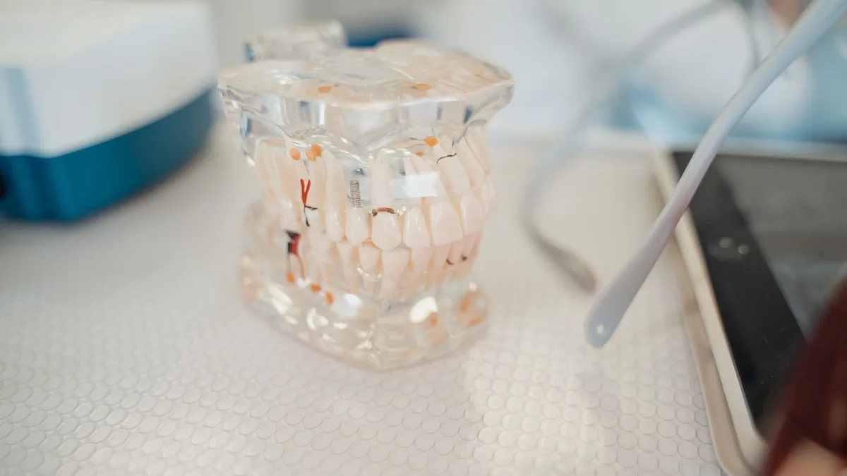 Close-up of a dental model on a clinic table, showcasing teeth anatomy.