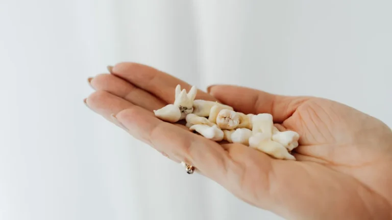 Close-up image of human teeth held in a hand, set against a white background.