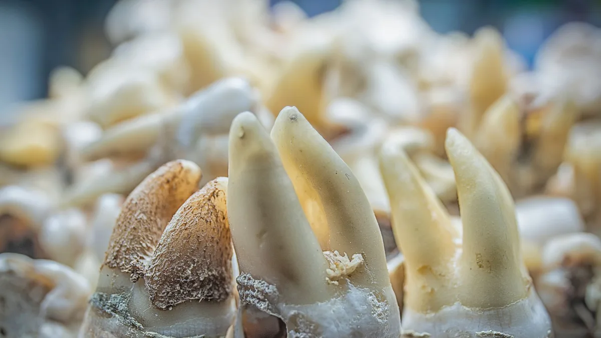 Detailed macro shot of decaying human teeth, showcasing cavity and dental issues.