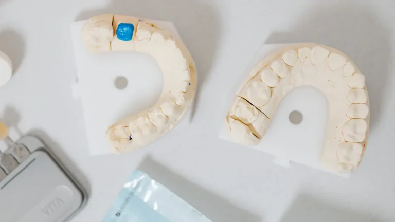 Close-up of dental molds on a white table, showcasing orthodontic details.